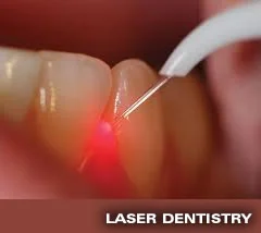 A dental laser treating gum tissue